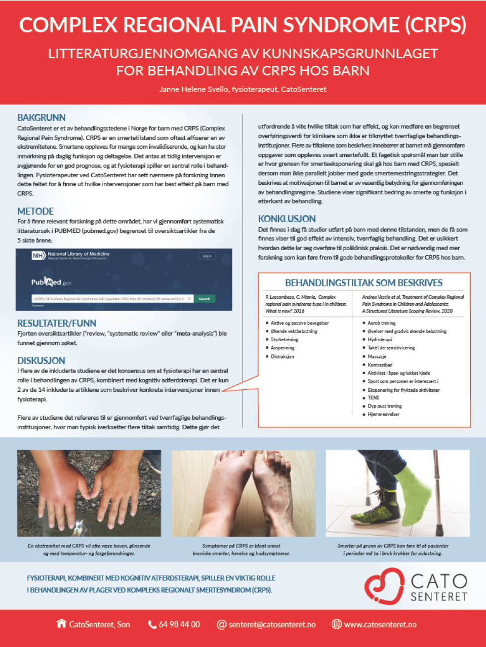 Poster om litteratursøket, presentert på Fysioterapikongressen 2022. CRPS poster