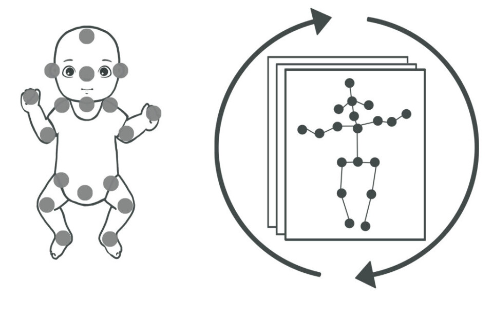 Illustrasjon ved Lars Adde, Senter for Innovasjon, Medisinsk Utstyr og Teknologi (SIMUT),St. Olavs Hospital
